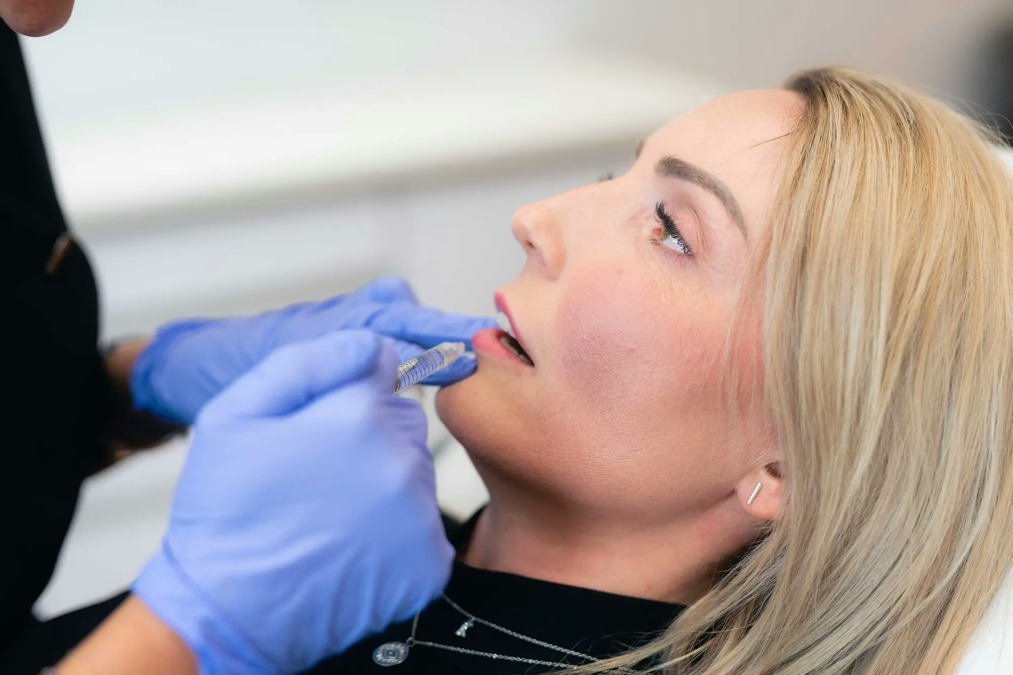 Blonde Frau beim Schönheitseingriff Lippen Berlin